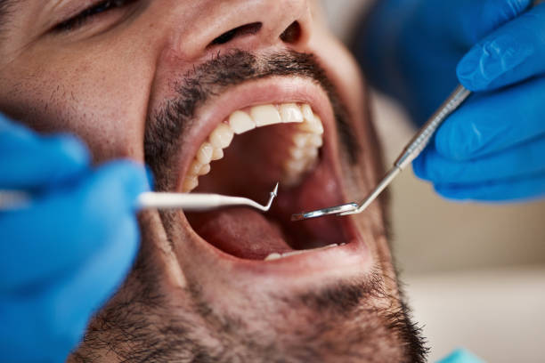 Best Dental Fillings (Composite and Amalgam)  in Malvern, OH